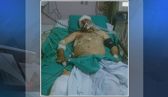 اولین تصاویر از خبرنگارِ زخمی ایران در لاذقیه