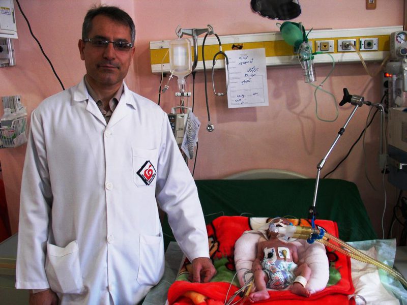 قلب نوزاد دوکیلویی با روش غیر جراحی حیات تازه یافت