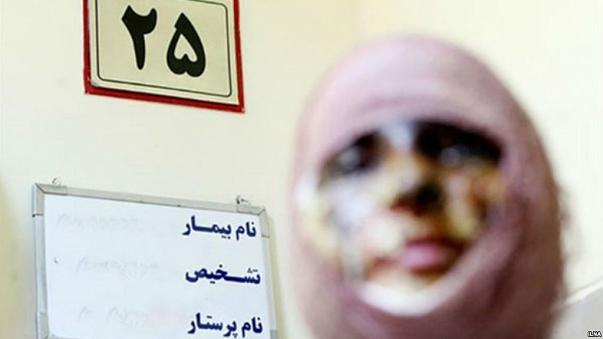 جزییات اسیدپاشی در تبریز/ قربانی دچار سوختگی ۵۰ درصد از ناحیه‎ی صورت شده است