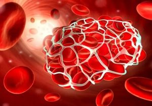 بیماران هموفیلی، همچنان منتظر باشند/ کمبودهای دارویی سراسری است