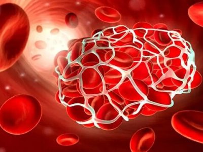 بیماران هموفیلی، همچنان منتظر باشند/ کمبودهای دارویی سراسری است