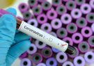 Türkiye’de son 24 saatte koronavirüsten 59 kişi hayatını kaybetti