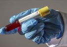 Koronavirüsü İran’da 73 can daha aldı